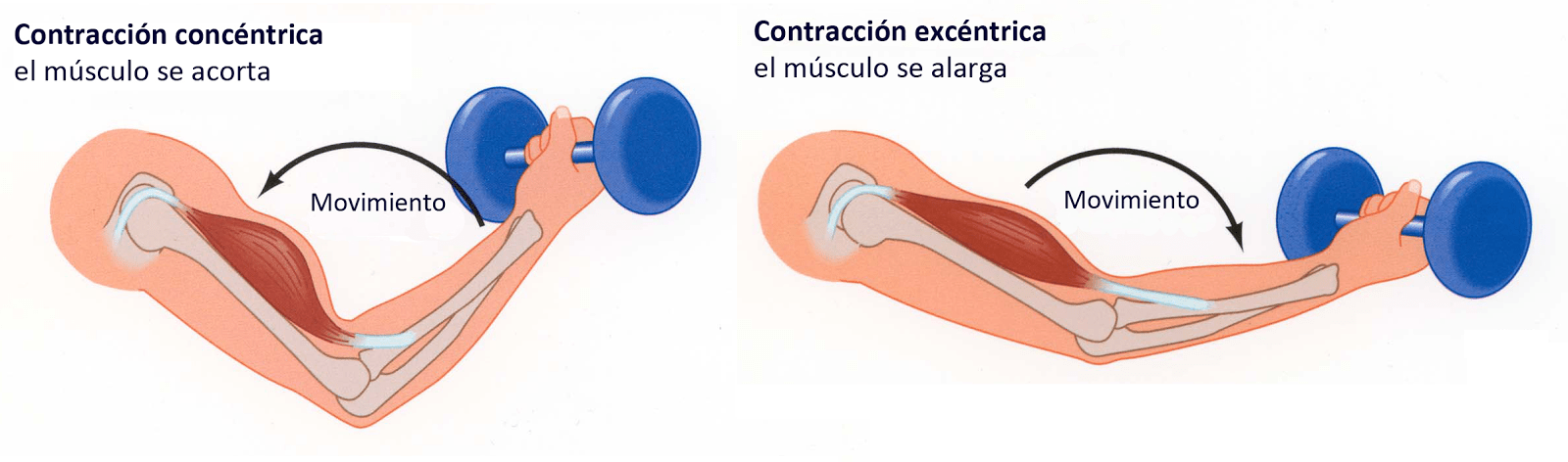 Cómo curar tendinitis ejercicios excéntricos