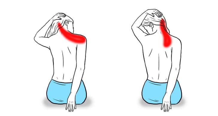 Lesiones camino de Santiago dolor cuello
