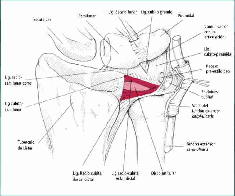 Lesión fibrocartílago triangular pádel