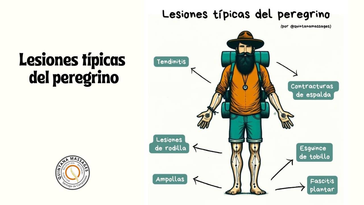 Lesiones más frecuentes del peregrino
